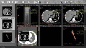 Скачать RadiAnt DICOM Viewer 2025.2 Build 13300 для ПК на Русском